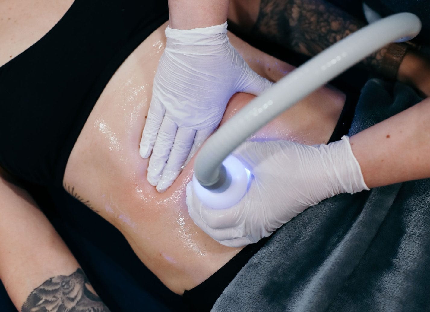Cryonick (VacuActivus) Iceberg Roller Mini Body Shaper