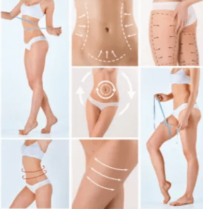 Cryonick (VacuActivus) Iceberg Roller Mini Body Shaper